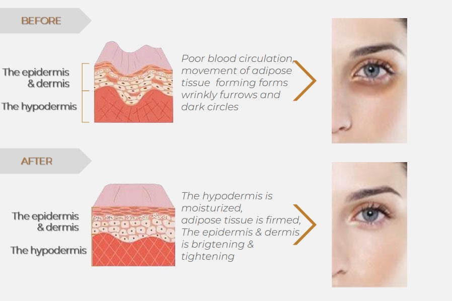 AVIF Bio-cellulose Under-Eye Patches